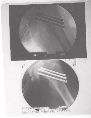 Supplements I took to heal